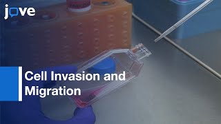 Scratch Wound Assay and Boyden Chamber Assay Comparison  Protocol Preview [upl. by Dnalwor]