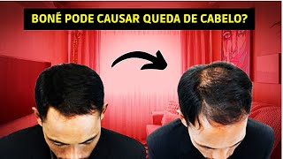 DESCUBRA SE O USO DE BONÉ ESTÁ RELACIONADO À QUEDA DE CABELO E CALVÍCIE [upl. by Song589]