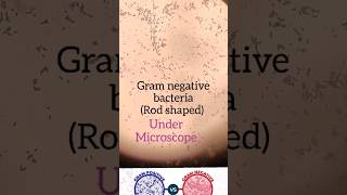 Bacteria under Microscope🔬gram positive vs gram negative bacteriamicrobiology [upl. by Hughmanick]