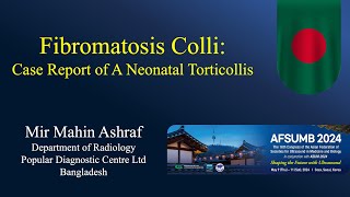 Fibromatosis Colli  Ultrasound  Case 340 [upl. by Emelun]