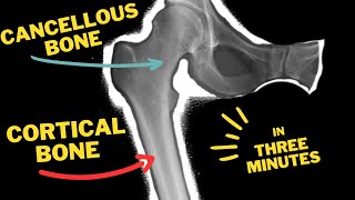 Cortical bone 🦴 Vs Cancellous bone 🦴  In Three minutes [upl. by Morvin77]