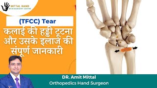 TFCC Injury In Hindi  TFCC Tear Repair Surgery And Stretches  कलाई की हड्डी टूटना व उसका उपचार [upl. by Refinej]