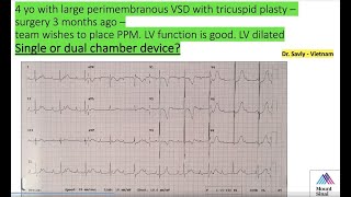 Pediatric EP Conference  Mount Sinai  3722 [upl. by Leeland]