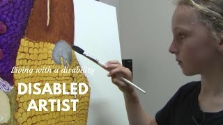 Talented Artist Living with Hip Dysplasia [upl. by Horace]