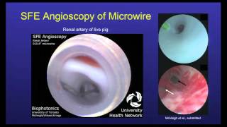 Eric Seibel Hot Topics presentation Scanning Fiber Endoscopy  Multimodes of Guided Intervention [upl. by Clapp]