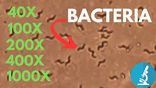 Bacteria under Microscope at Different Magnification  Do you really need 1000x [upl. by Mina]