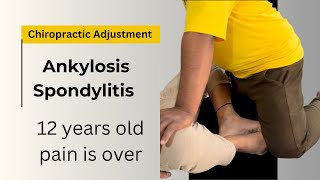 Ankylosing Spondylitis  Symptoms and Treatment Rheumatologist [upl. by Alesram]