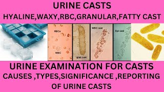 URINARY CASTS IN HINDI DIFFERENT TYPE OF CASTS IN THE URINECAUSES SIGNIFICANCE OF URINE CASTS [upl. by Sterne370]