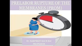 PRELABOR RUPTURE OF MEMBRANES PROMNOTES WITH EXPLANATION [upl. by Rives]