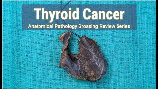 Thyroid Cancer  Neck Dissection  Anatomical Pathology Grossing Review Series [upl. by Nageek]