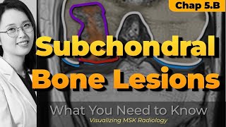 Chapter 5 B⎜Subchondral bone lesions ⎜Knee MRI⎜Visualizing MSK Radiology⎜Refer to timeline [upl. by Bury]