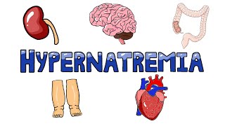 An Approach to Hypernatremia  Hypernatremia Diagnostic Algorithm  Hypernatremia Causes MADE EASY [upl. by Ahtiek393]