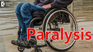 Paralysis  Causes Signs and Symptoms Types [upl. by Inoek]