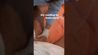 Fast Track to Recovery  Dry Needling for Groin Injuries shorts [upl. by Ycak909]