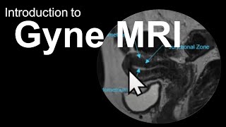 Introduction to Gyne MRI Female Pelvis CaseBased Course [upl. by Kuhn867]