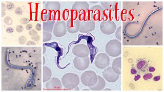 Hemoparasites pathology pathologylab hematology smear parasite [upl. by Lorne]