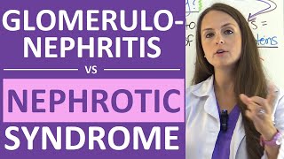 Nephrotic Syndrome vs Glomerulonephritis  Nephritic vs Nephrotic Syndrome Nursing NCLEX [upl. by Bowes590]