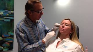 Belllafill Volumization of the Cheeks Pre Jowl Sulcus Jawline Steve Weiner MD [upl. by Darci259]