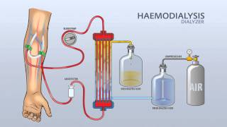 HAEMODIALYSIS DIALYZER [upl. by Brosy]