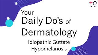 Idiopathic Guttate Hypomelanosis  Daily Dos of Dermatology [upl. by Dong408]