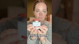 Is This Crème the Solution for Dry Eczema skin [upl. by Schaefer]