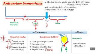 Antepartum hemorrhage  part 1 [upl. by Selinski]