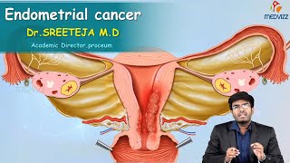 Endometrial Cancer  Obstetrics and gynaecology Video lectures Version 20  Medvizz app [upl. by Ackerley]