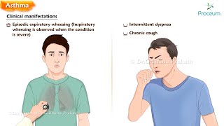 Asthma  Etiology Pathogenesis Clinical features Diagnosis and Treatment [upl. by Brand]