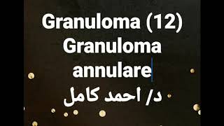 12 Granuloma annulare [upl. by Judie324]