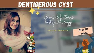 dentigerous cyst lecture I dental lectures [upl. by Atekram968]