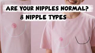 Types of Nipples Normal or Breast Cancer [upl. by Ready]