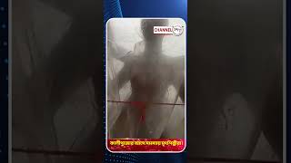 কালীপুজোর আগে সমস্যায় মৃৎশিল্পীরা [upl. by Analaj203]