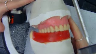 Prótese Total para iniciantes Parte 2  Montagem de Dentes Posteriores Superiores [upl. by Kenny533]