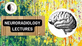 Tumors of the spine Part 1  Prof Dr Nahed Abdelgaber [upl. by Pillihpnhoj]