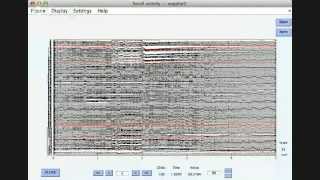 NBT course Lesson 2 Beta How to clean EEG signals [upl. by Yhtomiht]