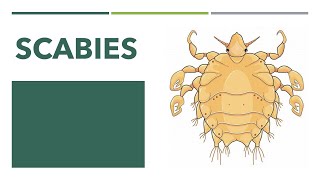 Scabies Lecture [upl. by Issor]