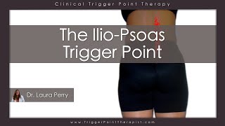 The Psoas Trigger Point [upl. by Norred825]