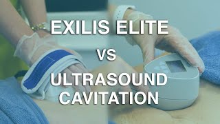 Exilis Elite vs Ultrasound Cavitation The Body Clinic  Exilis Elite Fat Reduction FAQ 🎯 [upl. by Yle]