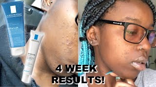 LA ROCHEPOSAY⎥HOW I TRIED TO CLEAR MY SKIN IN 4 WEEKS [upl. by Nylazor869]