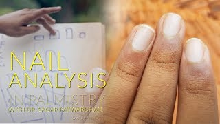 Learn Palmistry  Identifying Different Types of Nails and their Meaning 912 [upl. by Ahseal462]