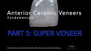 Anterior Ceramic Veneers Part 5 Super Veneer [upl. by Alano]