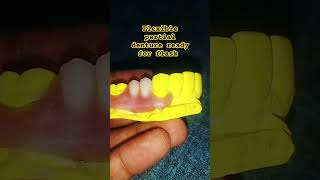 flexible partial denture by Ali dental ceramic dentist dentition dentalprosthesis teeth [upl. by Nnaj851]