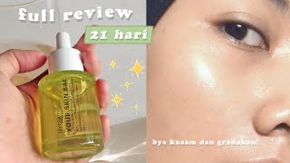 Review Avoskin Your Skin Bae Lactic Acid  Kiwi 21 HARI PEMAKAIAN [upl. by Philippine]