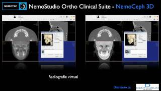 NemoStudio Ortho Clinical Suite [upl. by Cohette379]