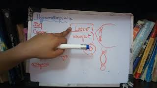 HYPERMETROPIA important topic full explanation part 1 [upl. by Brenda]