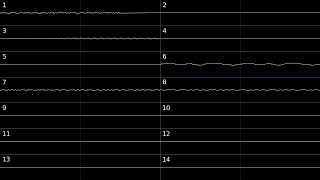 Big Money Deluxe Puzzle music Oscilloscope View [upl. by Jauch]