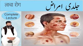 SKIN DISEASES  Causes amp treatment of SKIN DISEASES  Homeopathic DRMMUNAWAR DAWOOD [upl. by Nnovahs]