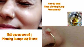 How to remove nose piercing bumps Home remedies to remove bump  Get rid of nose piercing bump fast [upl. by Tra]