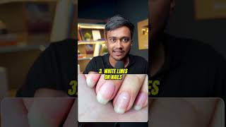 Check Your NAILS NOW shortsindia millionairemindset viralvideo [upl. by Madelyn]