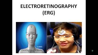 Electroretinography ERG and Electrooculography EOG [upl. by Tiertza925]